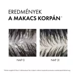VICHY Dercos Korpásodás elleni sampon száraz hajra 200ml