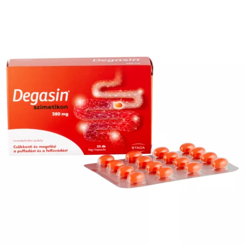 Walmark Degasin 280 mg lágy kapszula 32x