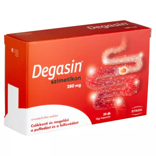 Walmark Degasin 280 mg lágy kapszula 32x