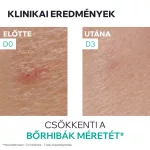 Uriage Hyséac SOS paszta pattanásokra 15g 