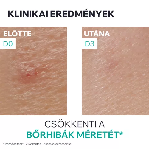 Uriage Hyséac SOS paszta pattanásokra 15g 