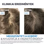 Uriage D.S. Hair intenzív sampon erősen korpás fejbőrre 150ml