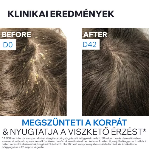 Uriage D.S. Hair intenzív sampon erősen korpás fejbőrre 150ml
