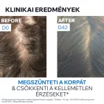 Uriage D.S. Hair sampon korpás fejbőrre 200ml