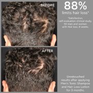   Apivita Sampon hajhullás ellen férfiaknak MEN'S TONIC 500ml