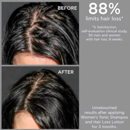 Apivita Sampon hajhullás ellen nőknek WOMEN'S TONIC 500ml