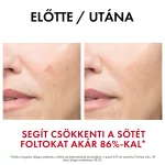 VICHY Liftactiv Specialist B3 szérum 30ml
