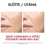 VICHY Liftactiv Specialist B3 szérum 30ml
