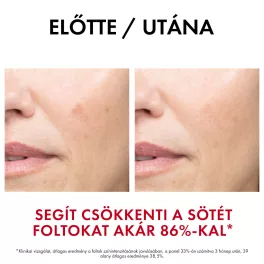 VICHY Liftactiv Specialist B3 szérum 30ml