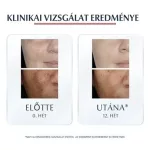 Eucerin Anti-Pigment színezett nappali arckrém medium SPF30 50ml
