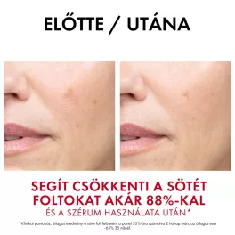 VICHY Liftactiv B3 Anti-dark spots krém SPF50 50ml
