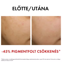   VICHY Liftactiv B3 Bőrtónus korrigáló éjszakai arckrém retinollal 50ml