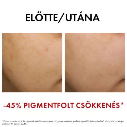 VICHY Liftactiv B3 Bőrtónus korrigáló éjszakai arckrém retinollal 50ml
