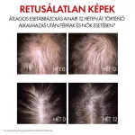 VICHY Aminexil Clinical R.E.G.E.N. BOOSTER hajregeneráló szérum