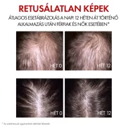   VICHY Aminexil Clinical R.E.G.E.N. BOOSTER hajregeneráló szérum