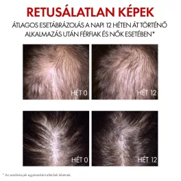   VICHY Aminexil Clinical R.E.G.E.N. BOOSTER hajregeneráló szérum