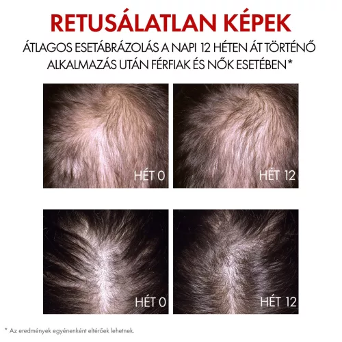 VICHY Aminexil Clinical R.E.G.E.N. BOOSTER hajregeneráló szérum
