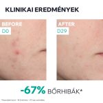 Uriage Hyséac new skin booster szérum bőrhibák ellen 30ml