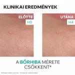 Uriage Hyséac szárító gél pattanások SOS kezelésére 15ml