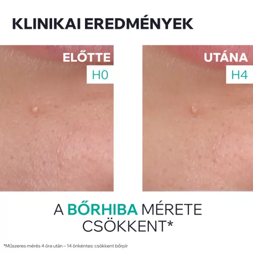 Uriage Hyséac szárító gél pattanások SOS kezelésére 15ml