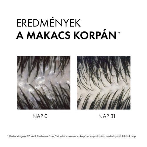 VICHY Dercos Korpásodás elleni sampon száraz hajra utántöltő 390ml