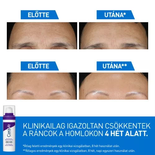 CeraVe Bőrmegújító Retinol Szérum 30ml
