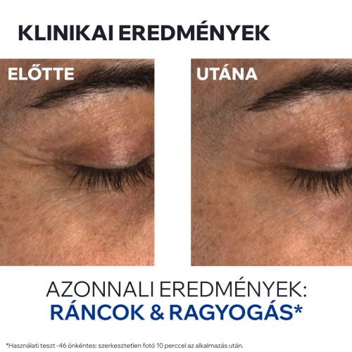 Uriage AGE ABSOLU Bőrtömörséget fokozó ránctalanító szemkörnyékápoló 15ml