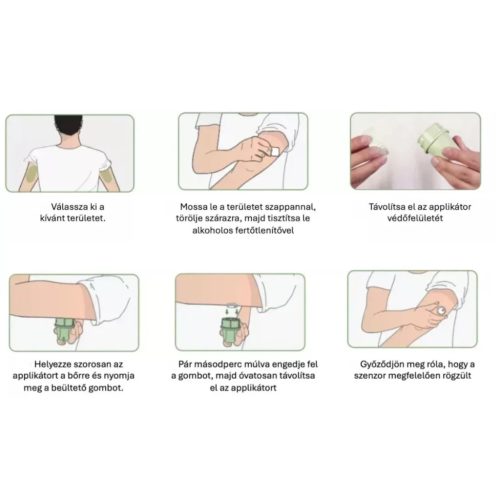 MicroTech LinX szenzor folyamatos vércukormérő