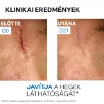 Uriage Bariéderm-Cica CU-ZN krém 15ml