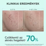 Apivita Bee Tech Just Bee Clear szérum bőrhibák ellen 30ml