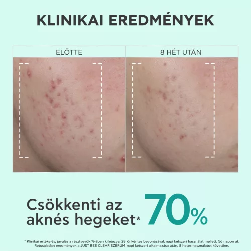 Apivita Bee Tech Just Bee Clear szérum bőrhibák ellen 30ml