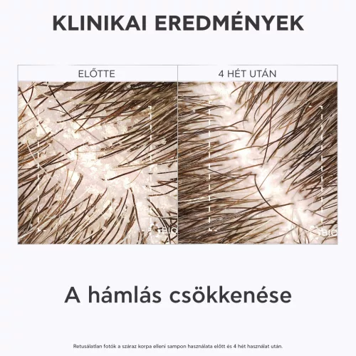 Apivita sampon száraz korpa ellen - utántöltő 500ml