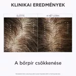 Apivita sampon száraz korpa ellen - utántöltő 500ml