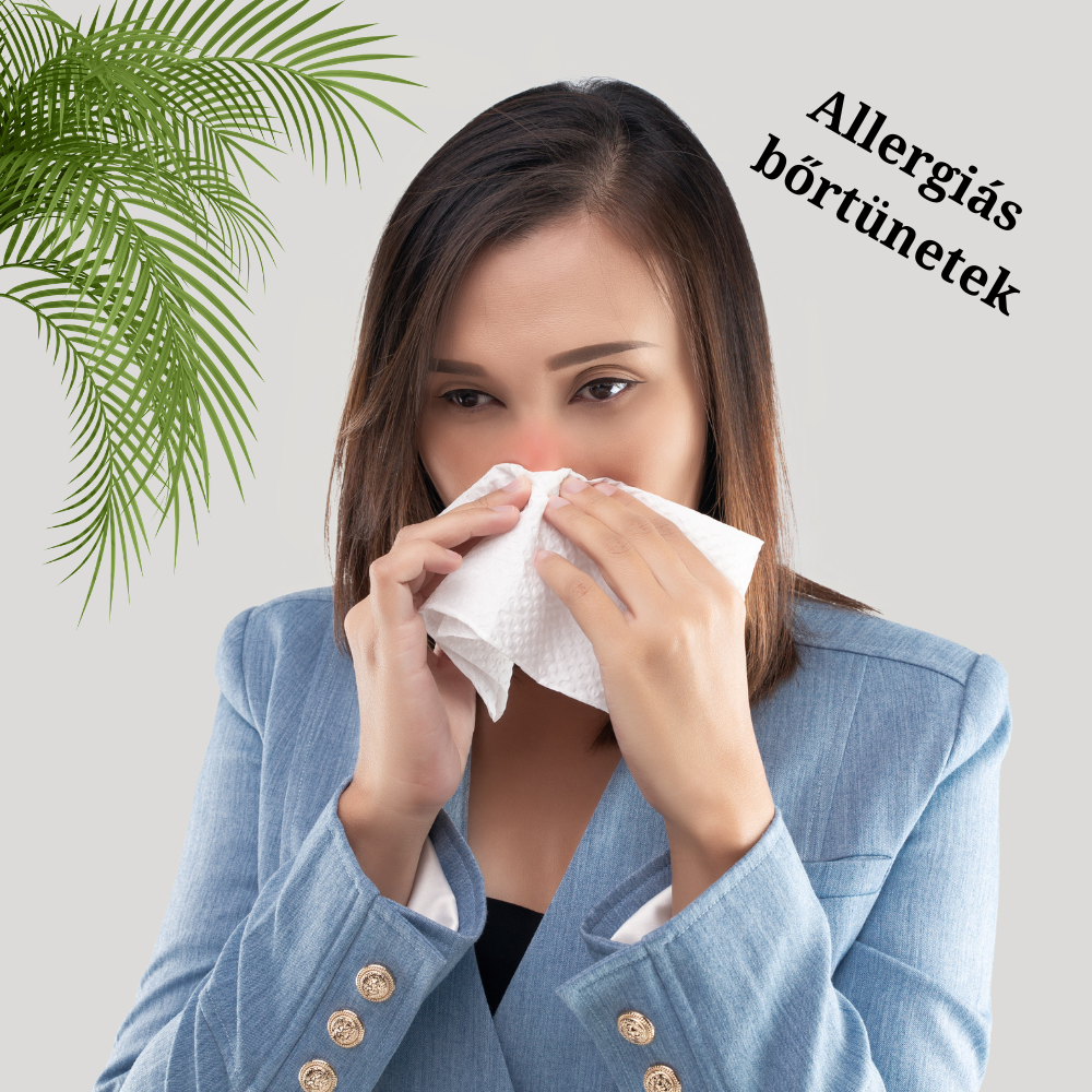 Allergiás bőrtünetek – mit tehetsz az irritáció és viszketés ellen?
