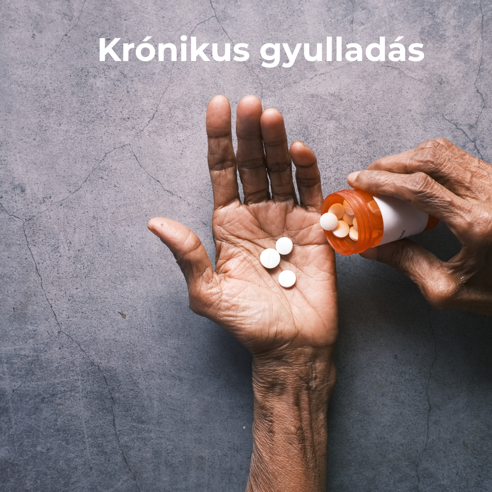  Gyulladás a szervezetben – tünetek, okok és a leghatékonyabb természetes megoldások 