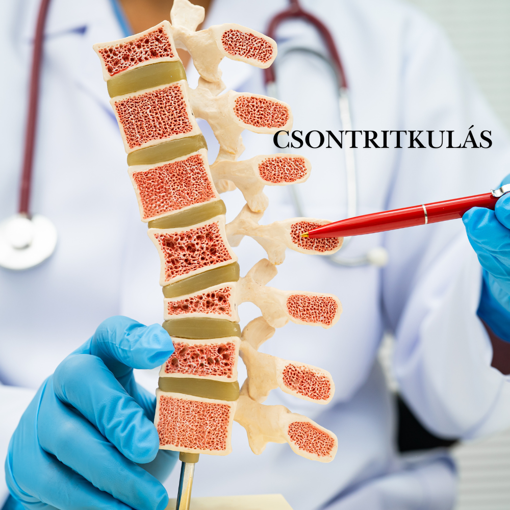 🦴 Csontritkulás nem csak időskorban